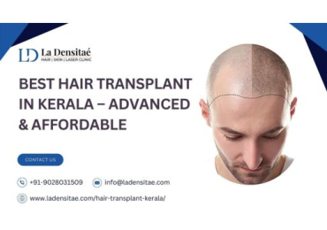 Best Hair Transplant in Kerala