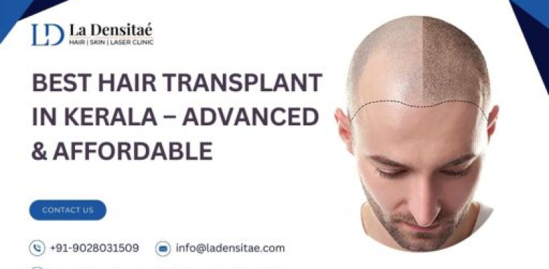 Best Hair Transplant in Kerala