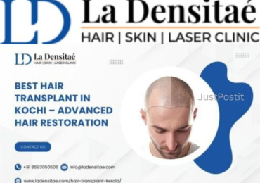 Best Hair Transplant in Kochi