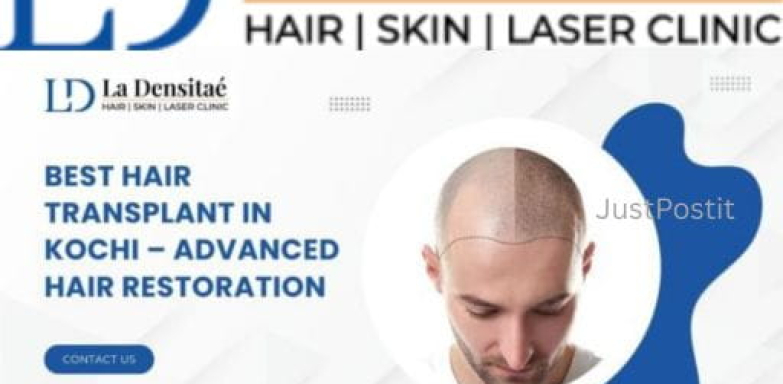 Best Hair Transplant in Kochi