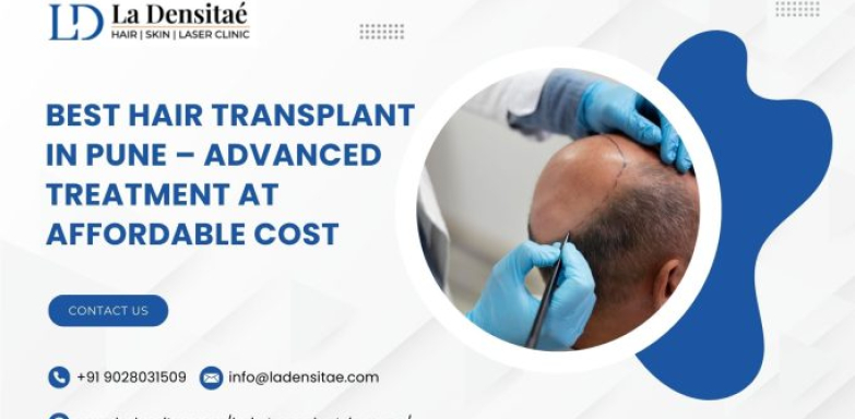 Best Hair Transplant in Pune