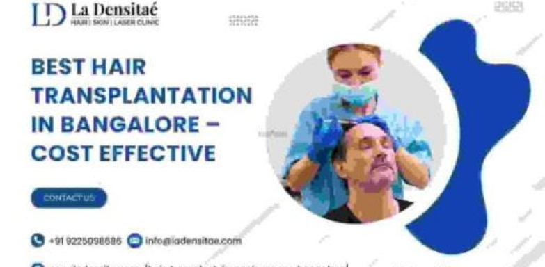 Best Hair Transplantation in Bangalore