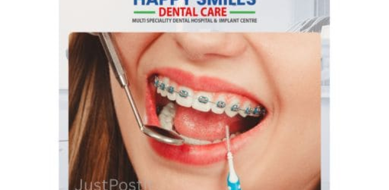 Invisalign Braces in Vanasthalipuram for a Confident Smile