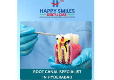 Painless Root Canal Specialist in Hyderabad